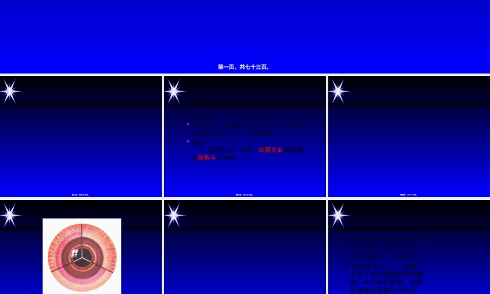 2022年医学专题—结膜炎.ppt