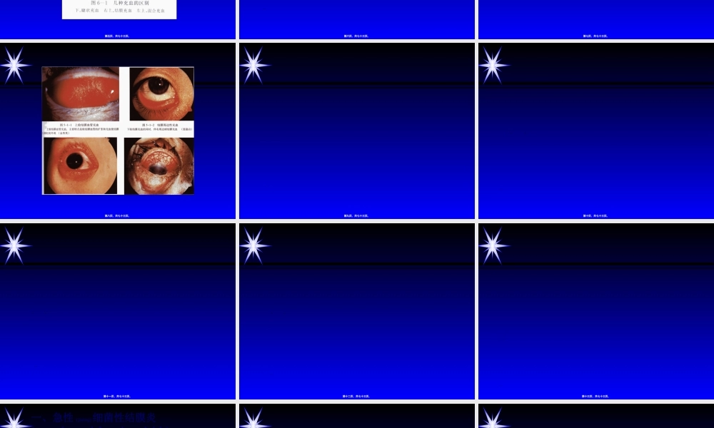 2022年医学专题—结膜炎.ppt