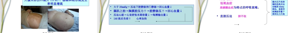 2022年医学专题—腹腔间隔室综合征及腹内压监测.ppt