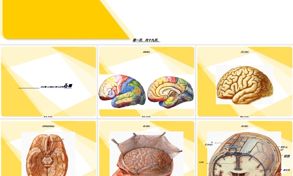 2022年医学专题—脑出血钻孔抽吸引流术.ppt