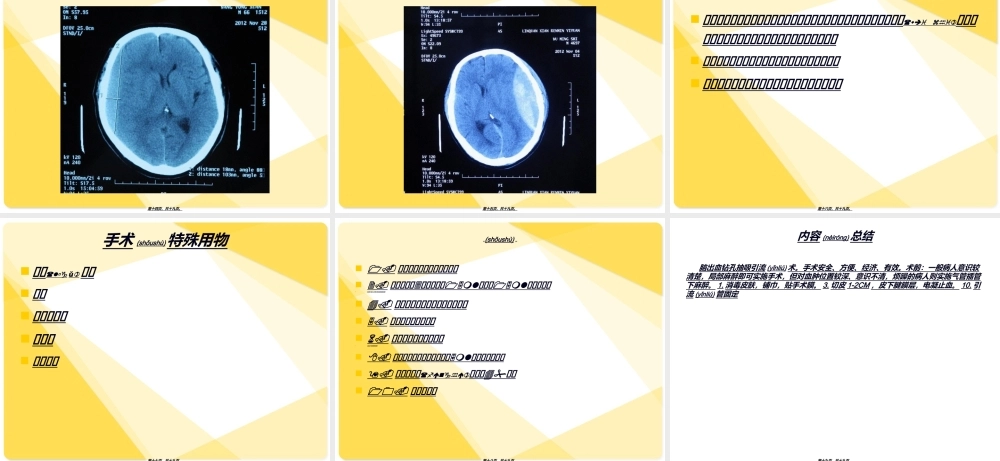 2022年医学专题—脑出血钻孔抽吸引流术.ppt