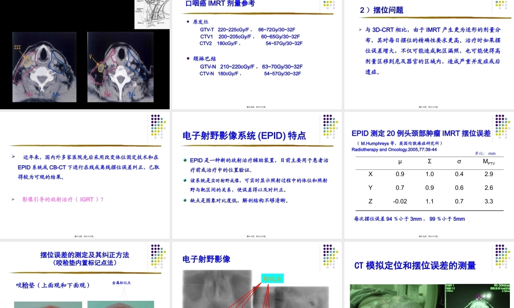 口腔癌精确放疗.pptx