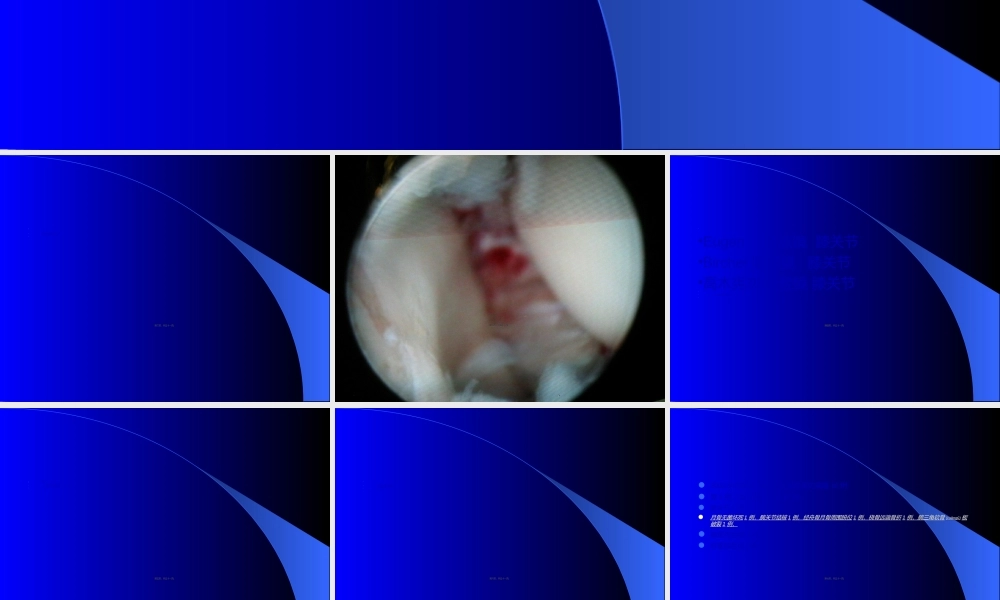 2022年医学专题—内窥镜在手外科的应用.ppt