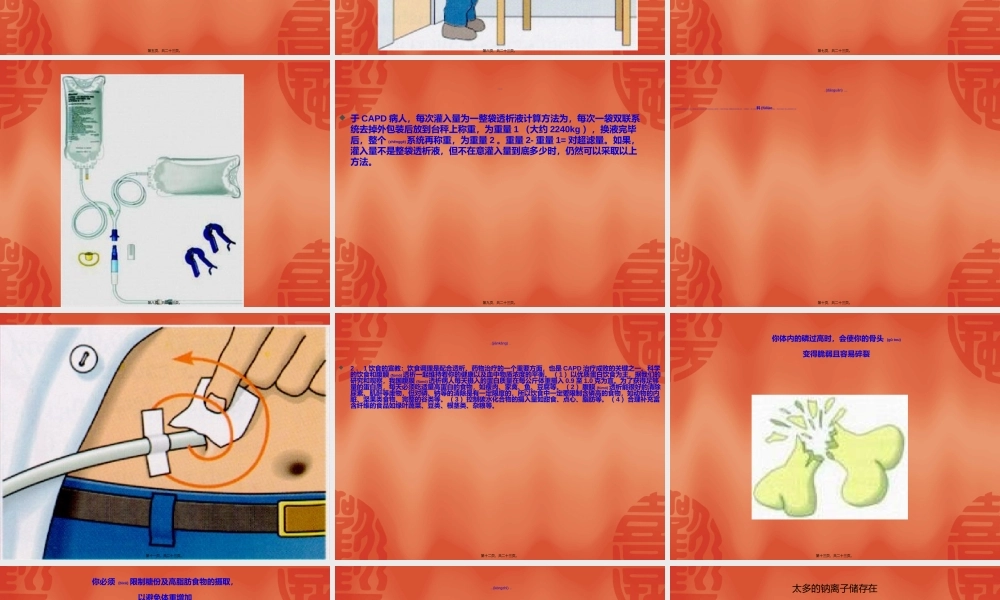 2022年医学专题—持续性非卧床腹膜透析病人在住-----------------------------------------------院资料.ppt