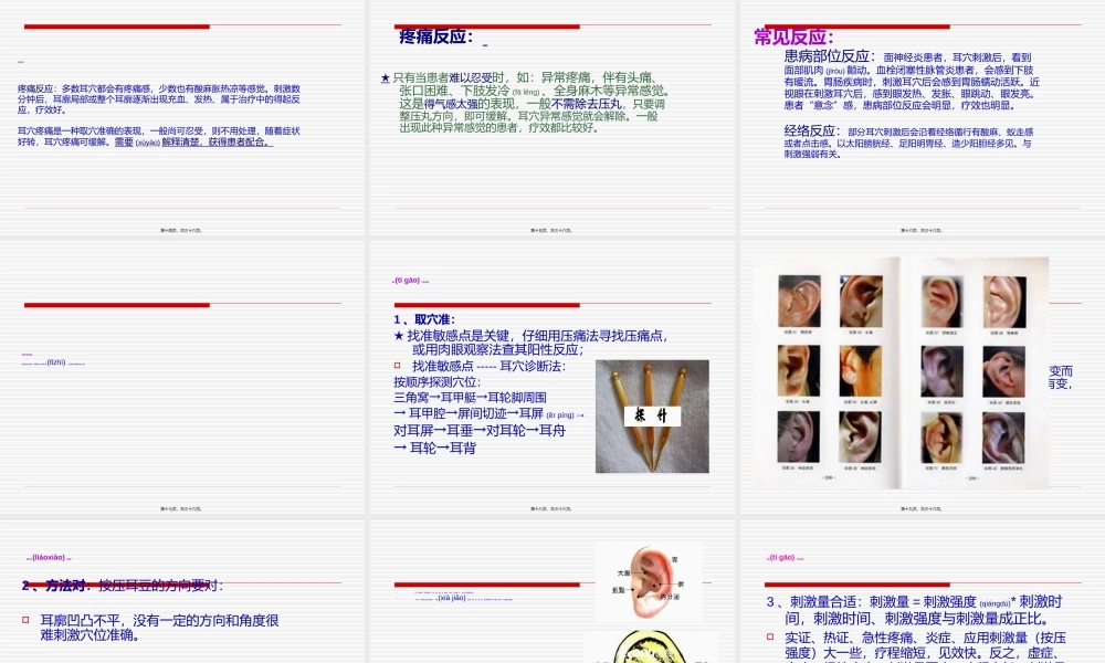 2022年医学专题—耳穴压豆法..ppt