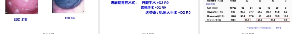 2022年医学专题—胃癌综合诊治第3版.ppt