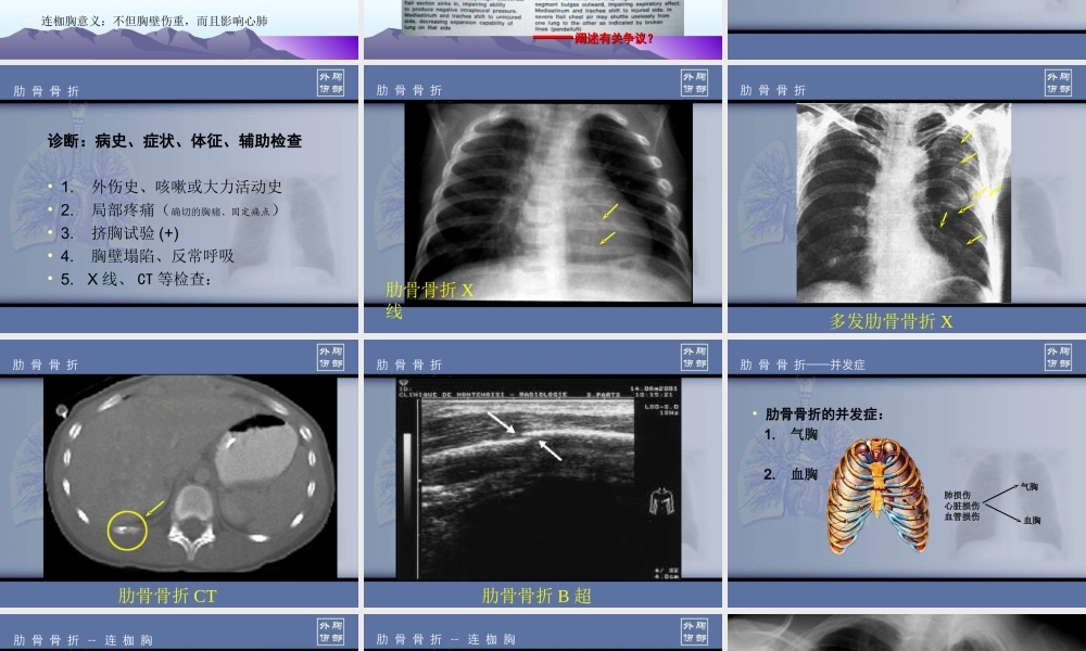 胸部损伤肋骨骨折.ppt