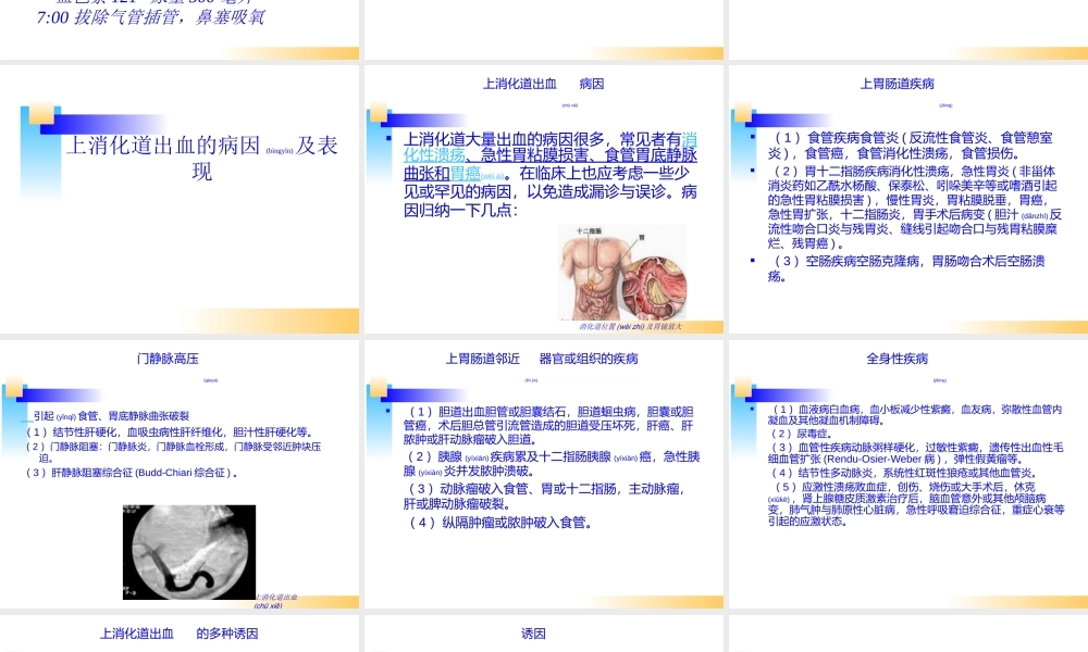 2022年医学专题—消化道出血教学查房.ppt