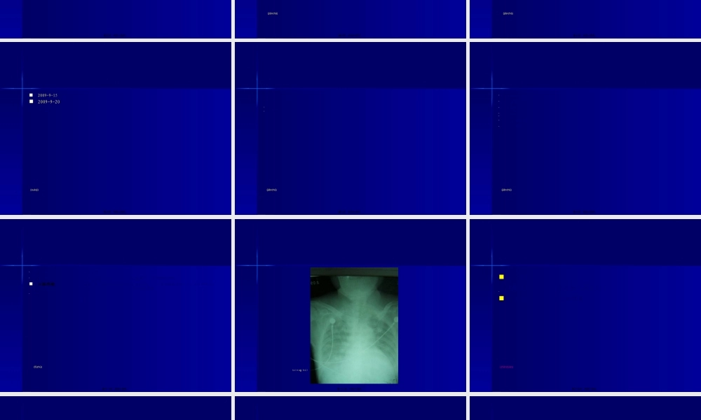 2022年医学专题—病例讨论-柯丹.ppt