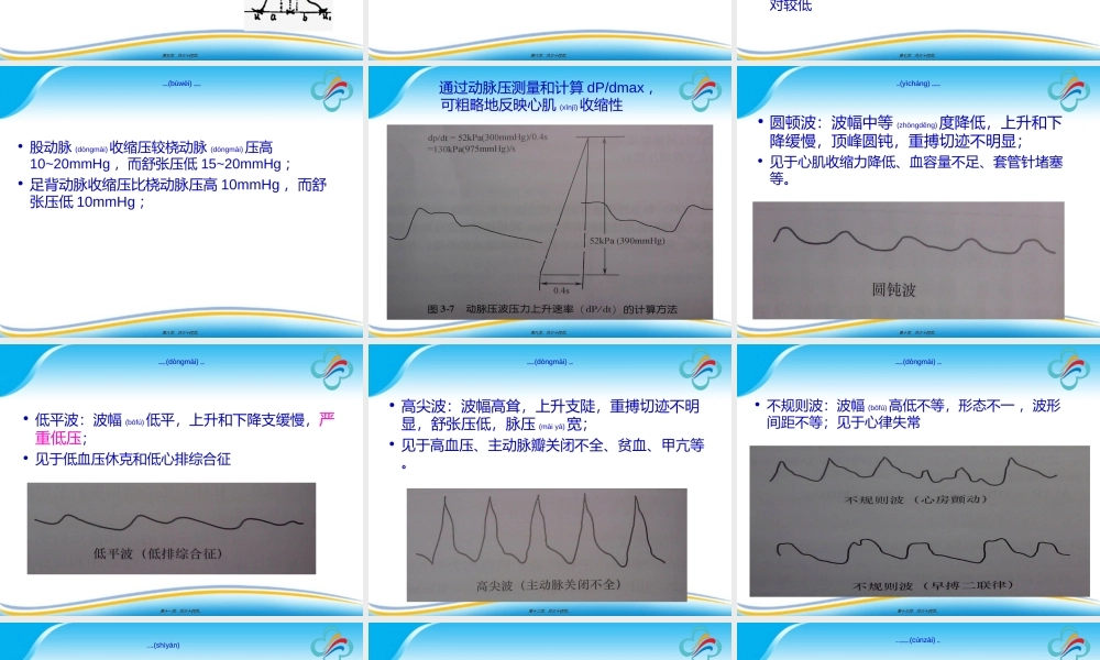 2022年医学专题—有创动脉血压监测的探讨.ppt