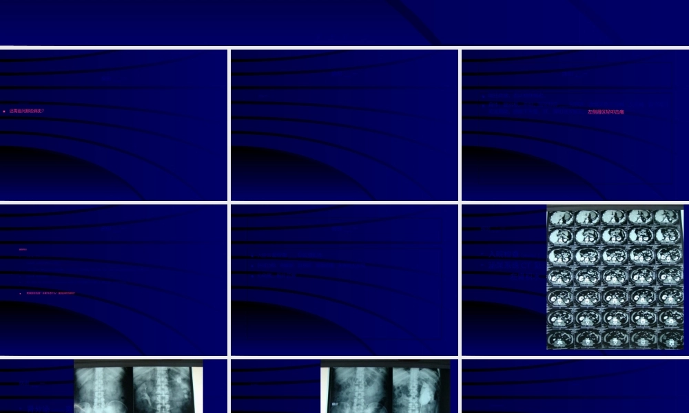 2022年医学专题—泌尿外科病例讨论.ppt