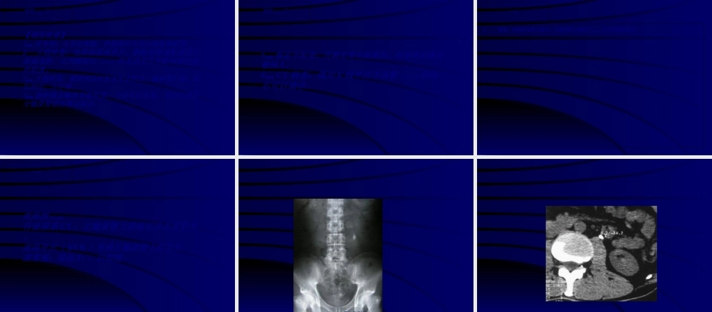 2022年医学专题—泌尿外科病例讨论.ppt
