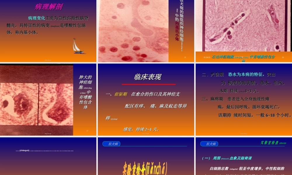 2022年医学专题—狂犬病.ppt