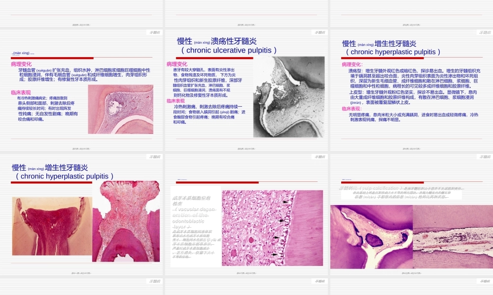 2022年医学专题—第10-11章-牙髓病与根尖周炎.ppt