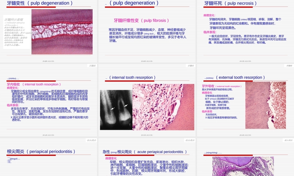 2022年医学专题—第10-11章-牙髓病与根尖周炎.ppt