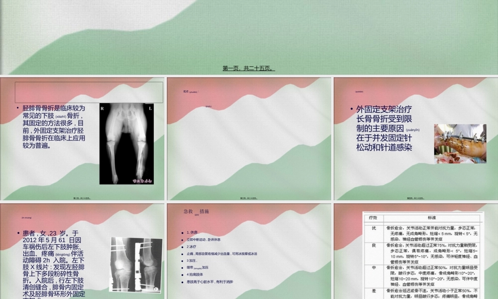 2022年医学专题—胫骨外固定支架.ppt