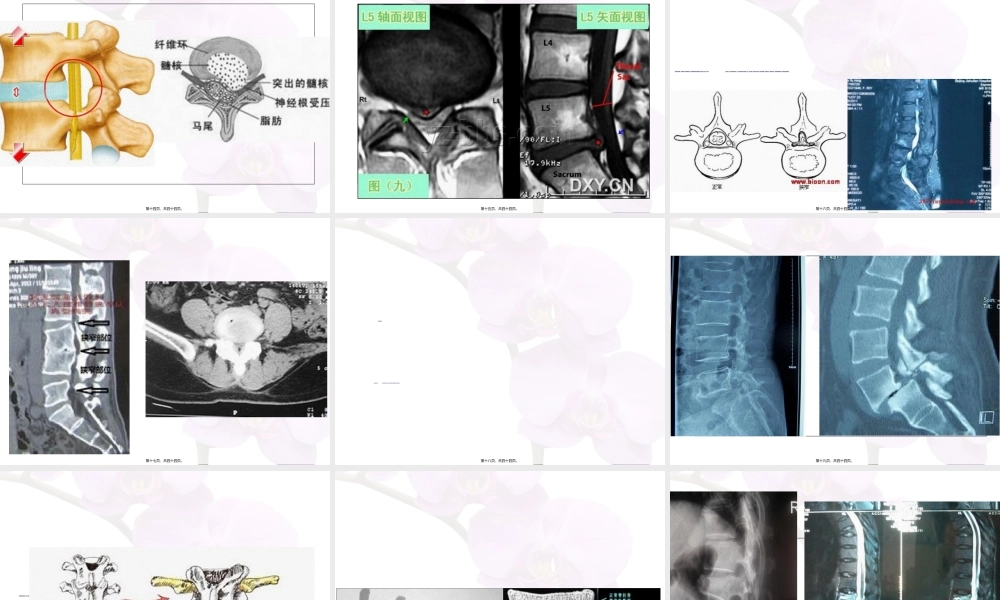 2022年医学专题—老年人腰腿痛科普讲座.ppt