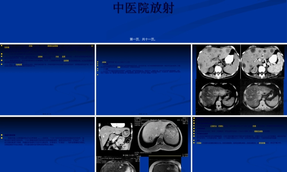 2022年医学专题—肝血管瘤影像学.ppt