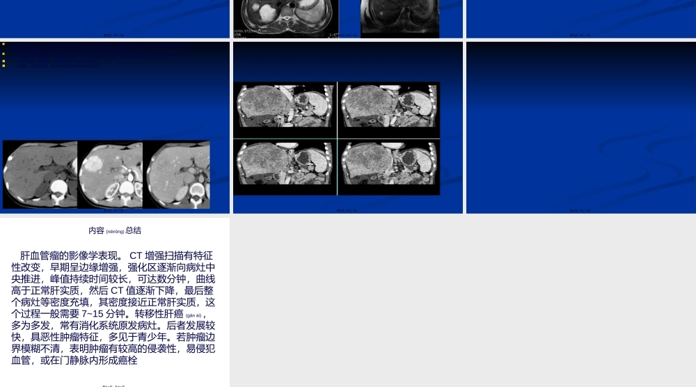 2022年医学专题—肝血管瘤影像学.ppt