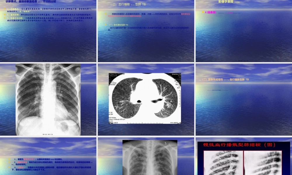 2022年医学专题—肺TB.ppt