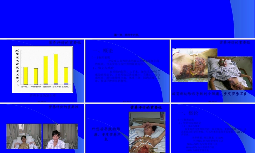 危重病人的营养支持-文档资料.pptx