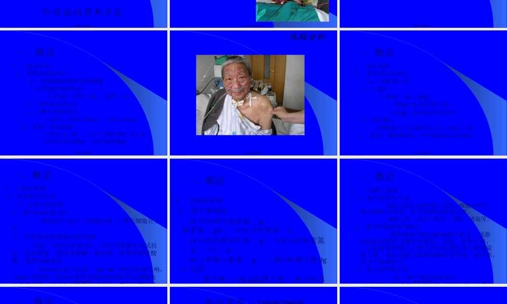 危重病人的营养支持-文档资料.pptx