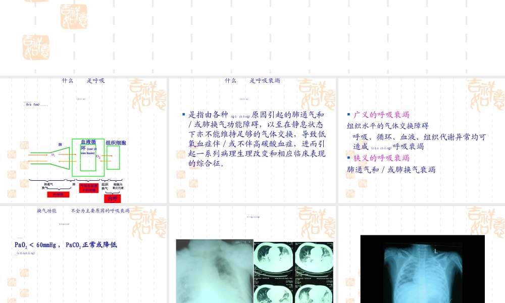 2022年医学专题—儿童呼吸衰竭与血气分.ppt