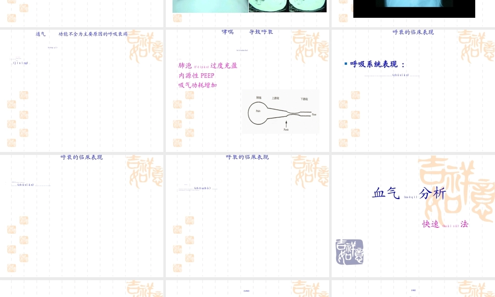 2022年医学专题—儿童呼吸衰竭与血气分.ppt