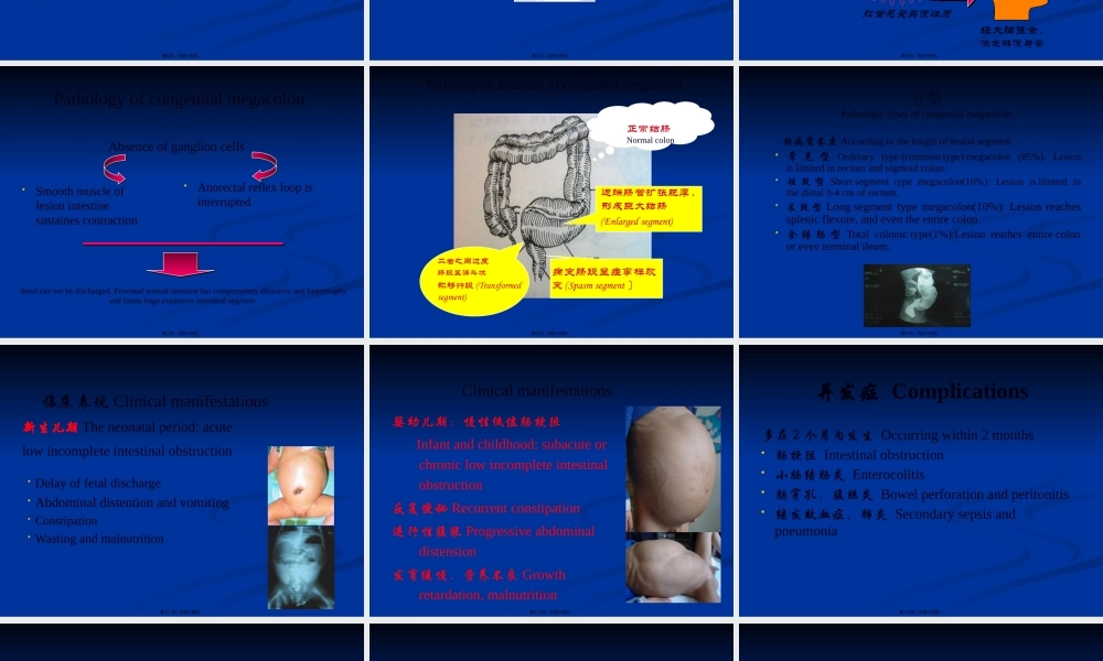 先天性巨结肠与胆道剖析.pptx
