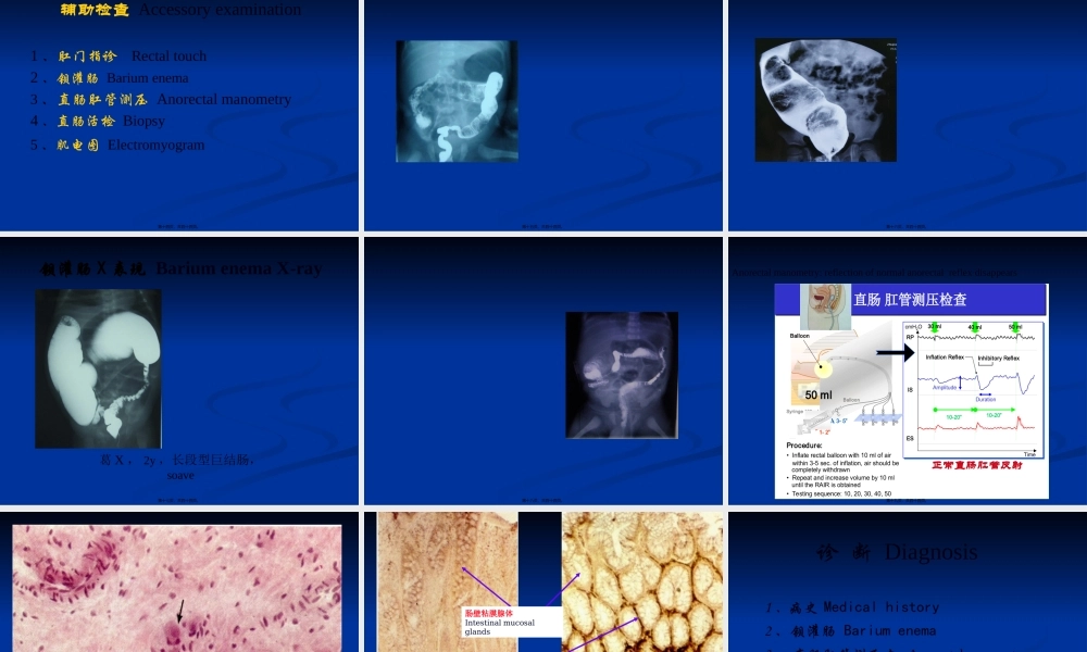 先天性巨结肠与胆道剖析.pptx