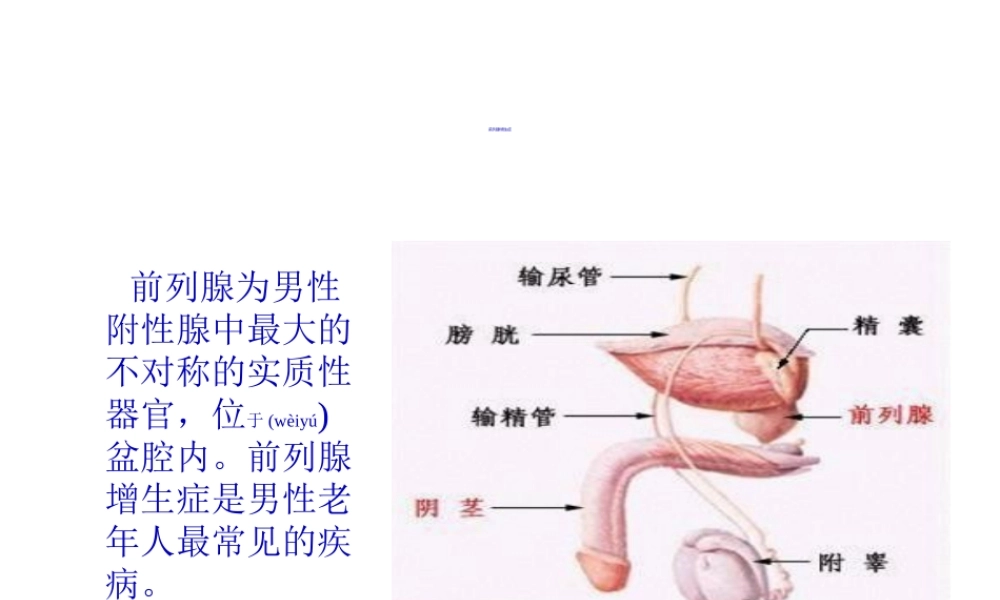 2022年医学专题—前列腺增生症.ppt