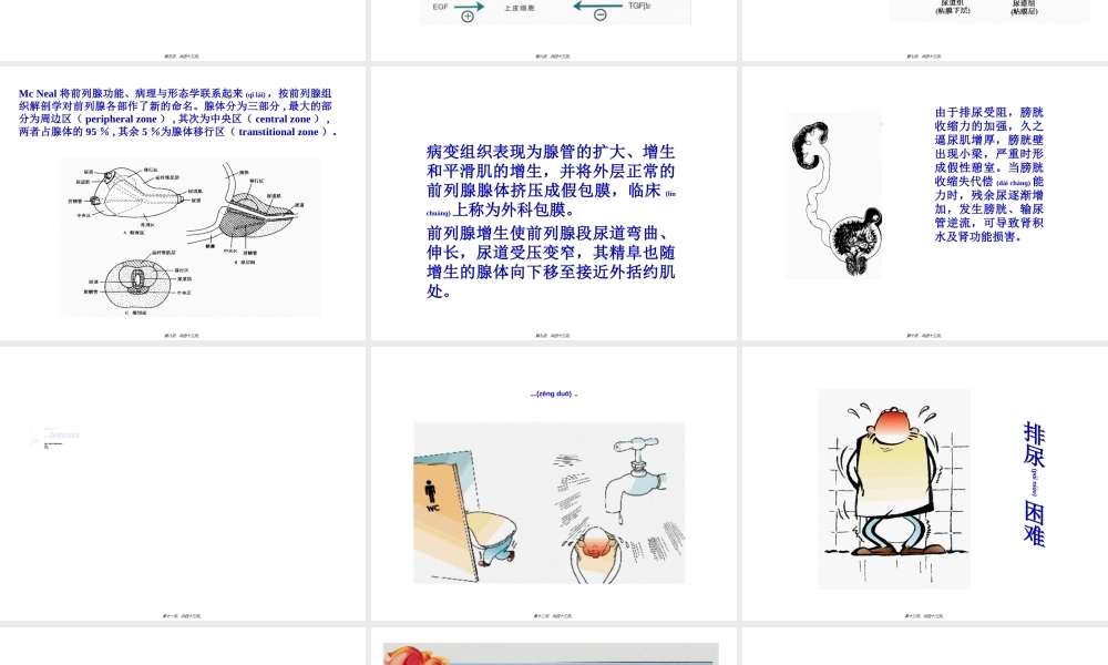 2022年医学专题—前列腺增生症.ppt