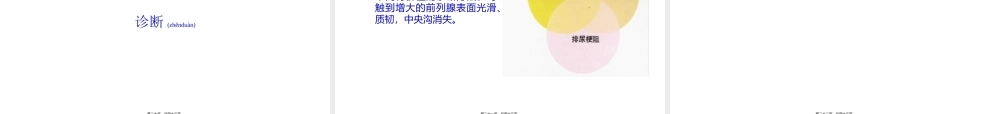 2022年医学专题—前列腺增生症.ppt