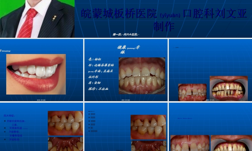 2022年医学专题—牙周炎知识.ppt