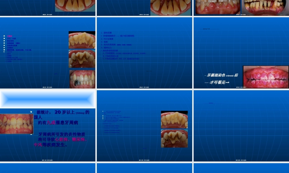2022年医学专题—牙周炎知识.ppt