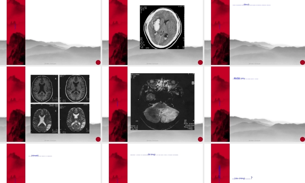 2022年医学专题—甘露醇规范应用及脑出血的诊疗流程.ppt
