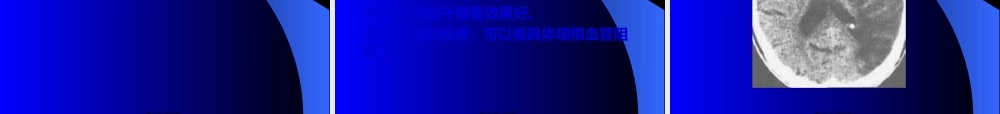 2022年医学专题—第八章-脑血管疾.ppt