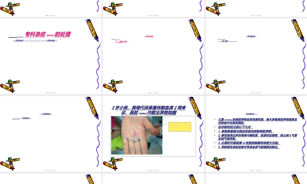 2022年医学专题—耳鼻喉科常见急症的处理.ppt