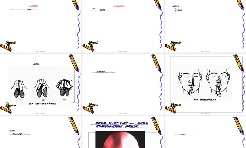 2022年医学专题—耳鼻喉科常见急症的处理.ppt