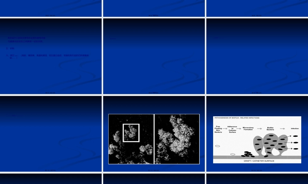 2022年医学专题—腹膜透析相关性腹膜炎.ppt