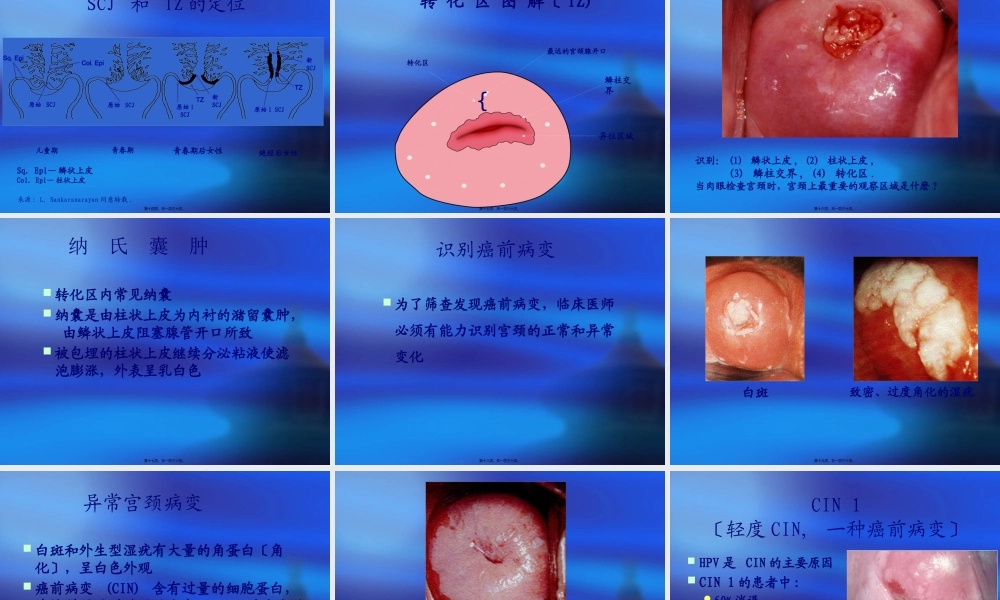 宫颈癌筛查技术推广.pptx