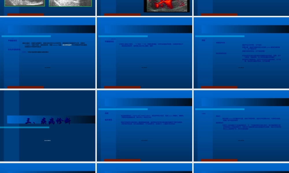 2022年医学专题—泌尿B超.ppt