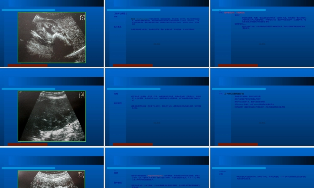2022年医学专题—泌尿B超.ppt