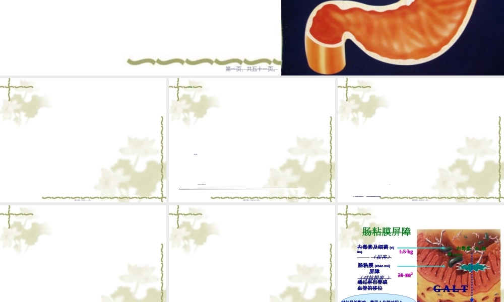 2022年医学专题—经皮胃镜下胃造瘘.ppt