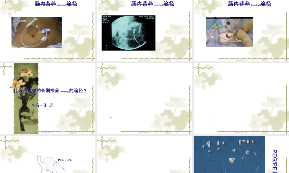 2022年医学专题—经皮胃镜下胃造瘘.ppt