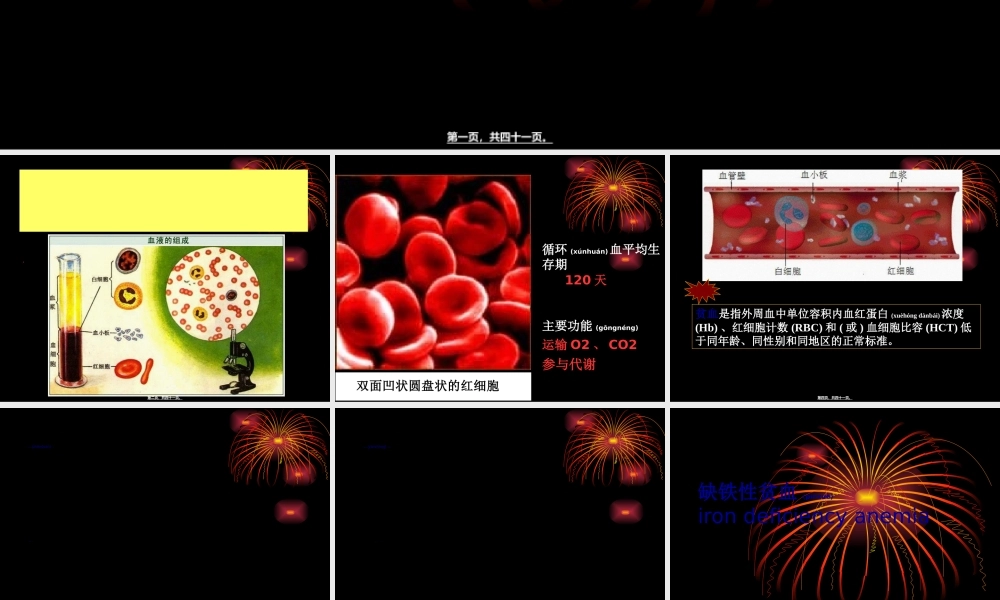 2022年医学专题—缺铁性贫血.ppttmp.ppt