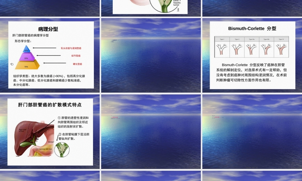 2022年医学专题—肝门部胆管癌.ppt