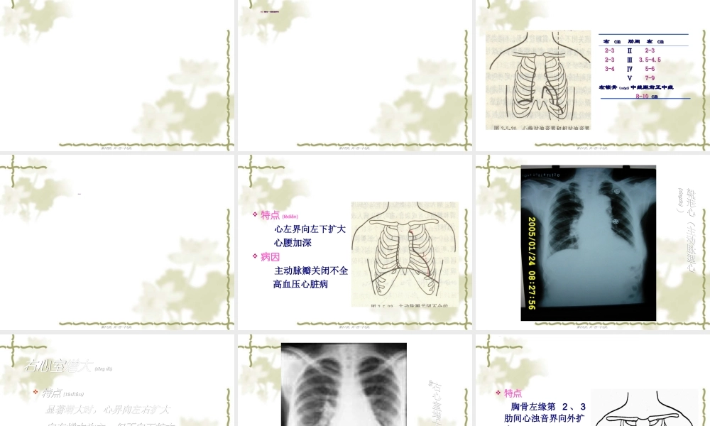 2022年医学专题—心脏检查0611.ppt