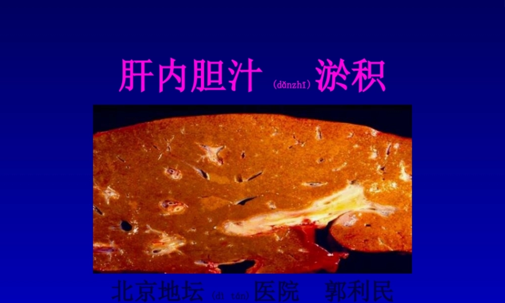 2022年医学专题—肝内胆汁淤积-武汉.ppt