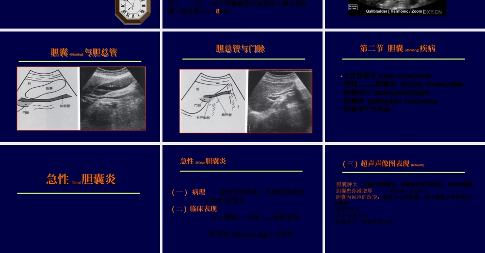 2022年医学专题—胆道超声.ppt